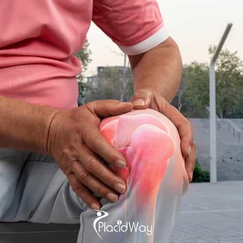 How University Clinics Use AI to Perfect Total Knee Replacements in Ankara?